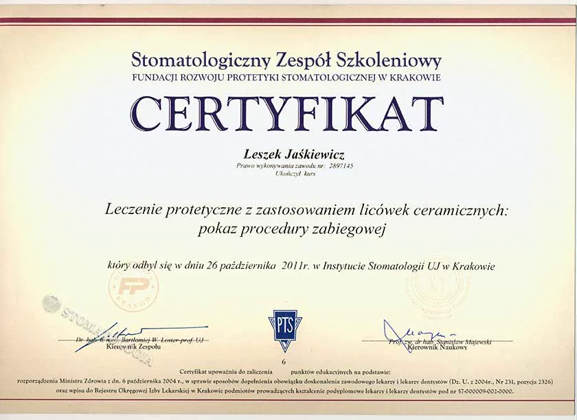 Licówki ceramiczne — estetyka uśmiechu